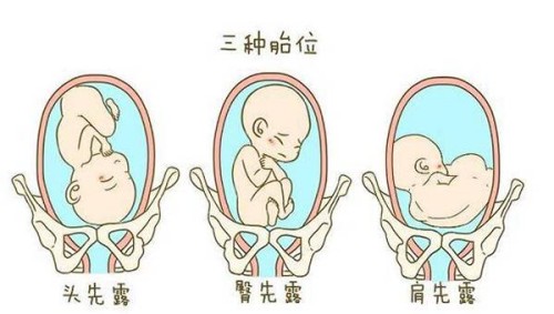西安供卵試管：赴美生子：十大優(yōu)勢與父母應(yīng)考慮的風(fēng)險解析！
