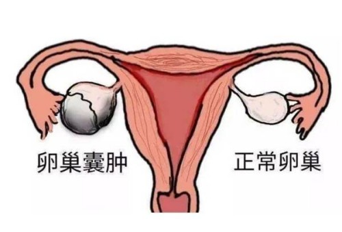 孕婦發(fā)熱一定要特別注意，小心對(duì)胎兒造成傷害