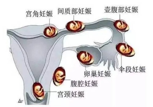 西安助孕生子：肇慶西江醫(yī)院試管嬰兒怎么樣？內(nèi)附技術(shù)介紹及其成功率