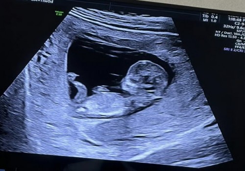 西安供卵試管：2023新余婦幼保健院試管嬰兒全方位指南，費用明細及成功率參考