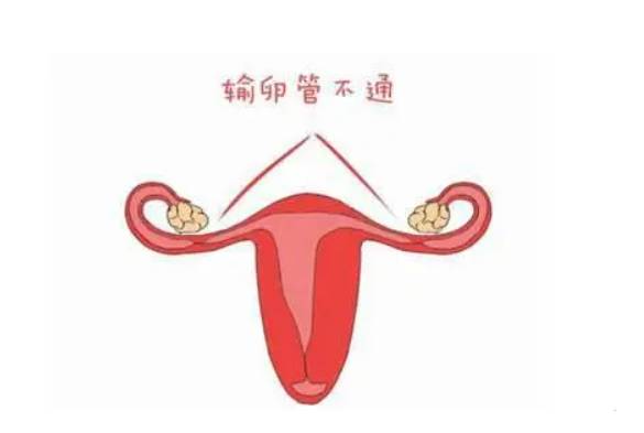 醫(yī)院精子庫(kù)免費(fèi)申請(qǐng)精子要多少錢(qián),免費(fèi)申請(qǐng)精子要什么條件