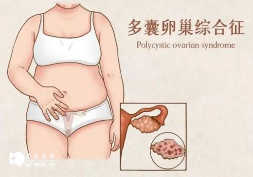 西安正規(guī)助孕機(jī)構(gòu)：剛出生不久的嬰兒打嗝,寶寶打嗝這樣緩解