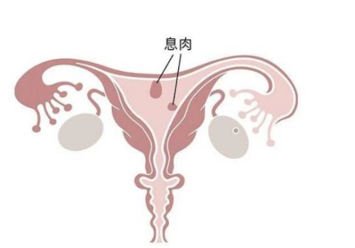 試管取卵后要注意什么,試管取卵后有哪些需要忌口的