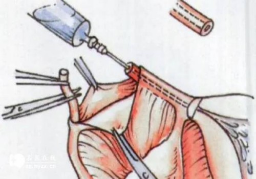 西安試管嬰兒價(jià)格：怎樣避免羊水渾濁而給胎兒帶來危害？